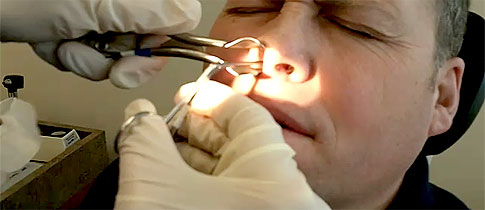 Nose_gag Nose_gag